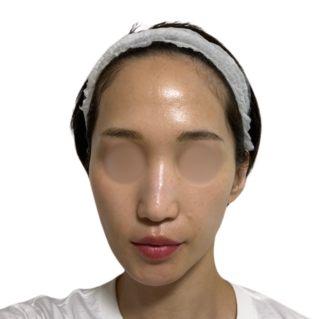 パーティーリフト（スマスアップネオ）